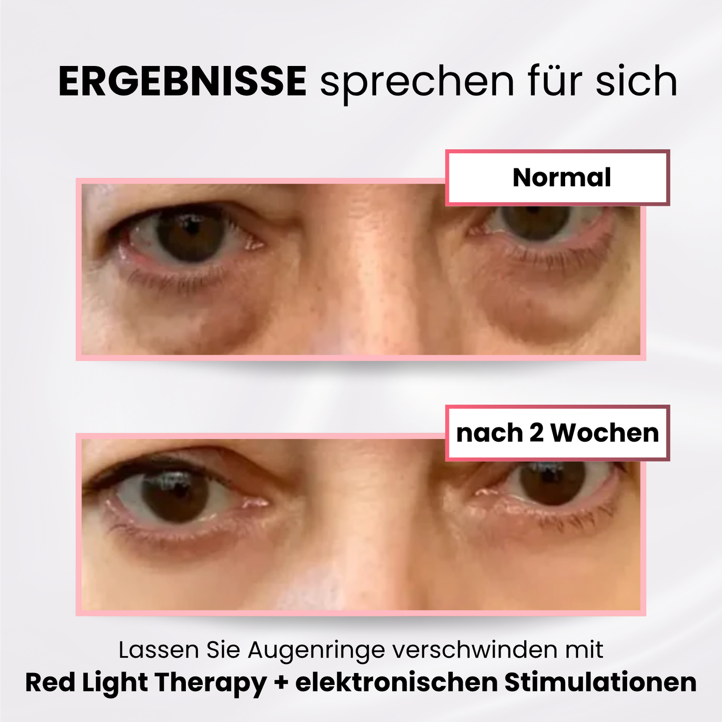 Celestique® 2-in-1 Red Light + EMS gegen Augenringe