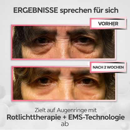 Celestique® 2-in-1 Red Light + EMS gegen Augenringe